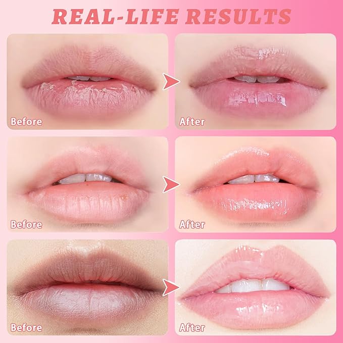 3 Pcs Honey Lip Balm, Bee Lip Balm Honey Pot,Moisturizing Lip Mask Overnight,Hydrate Repair Prevent Dry Cracked Lip Care (Honey+Strawberry+Watermelon)-FemmiqueWomen