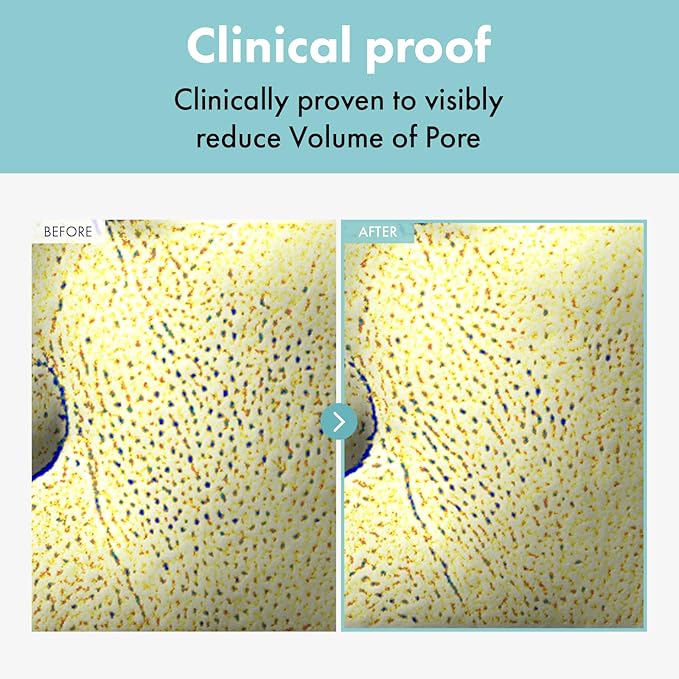 Pore Refiner Cream, Face Cream, Pore Extractor, Pore Minimize & Reducer and Remover. Best Pore Minimizer Treatment. Moisturizer for Oily Skin. K Beauty, Korean Skincare, 50g, 1.76 oz.-FemmiqueWomen