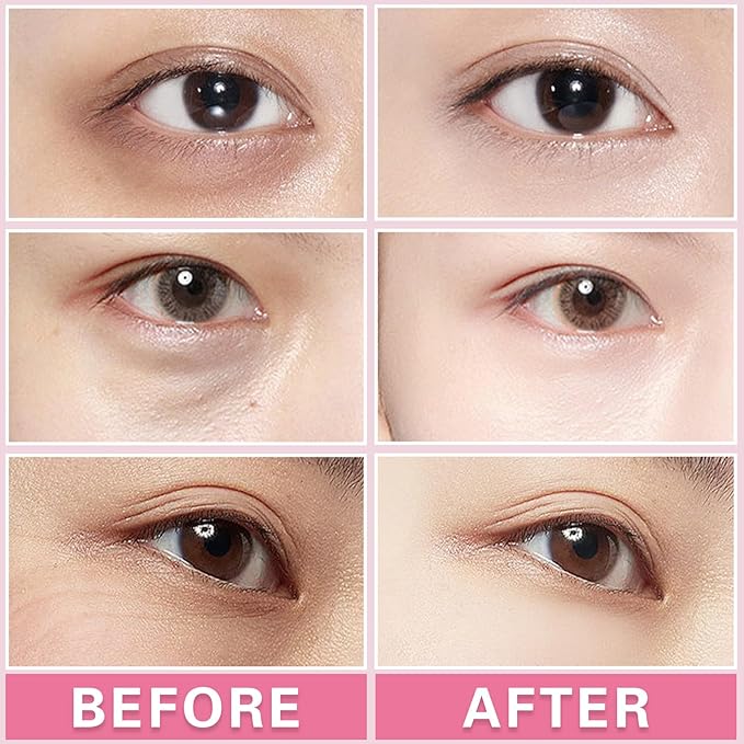 2PCS Under Eye Cream Lift Firm Skin Around the Eyes-FemmiqueWomen