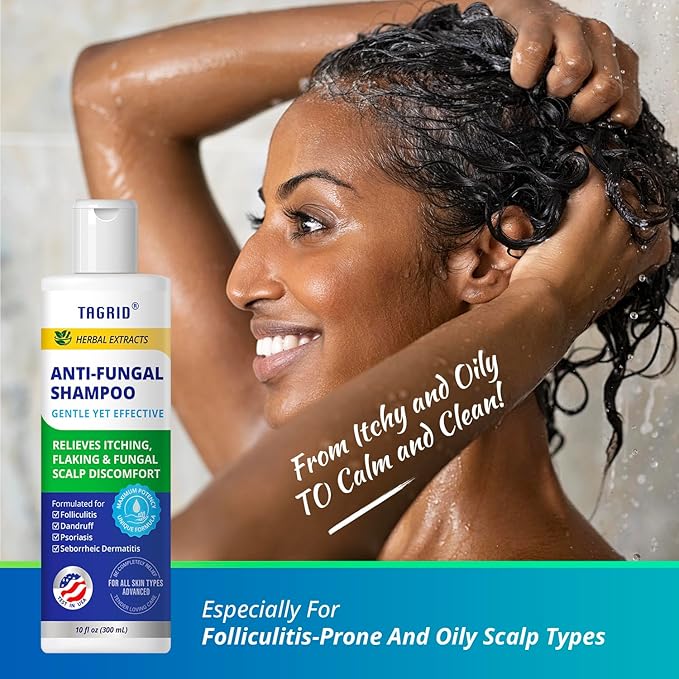 TAGRID Anti-Fungal Shampoo 300mL – Scalp Treatment for Psoriasis, Seborrheic Dermatitis, Folliculitis, Dandruff & Itchy Flaky Scalp – Soothing Plant-Based Formula for Men & Women-FemmiqueWomen