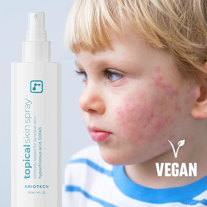 BRIOTECH Topical Skin Spray, Hypochlorous Acid Spray for Sensitive Skin, HOCl Facial Mist, Full Body Support Against Irritation, Calm Redness, Soothe Foot & Scalp, 2 oz Travel Size-FemmiqueWomen