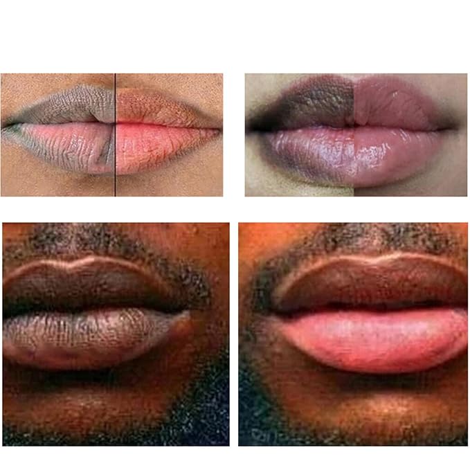 2pcs Lip Lightening for Dark Lips Lip Brightener for Smokers Dark Lip Treatment Lightening Cream for Pink Lips Lip Lightener for Smoker Lips Lip Lightening balm for Men and Women (Red)-FemmiqueWomen