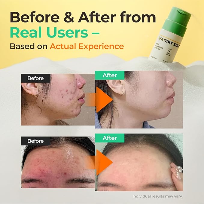 Watery Sulfur Pore Cleansing Powder, Korean Enzyme & Rice Powder & PHA Face Wash for Blackhead Removal, Sensitive and Acne-Prone Skin, Radiant Glow, Bumpy skin (1.76 oz / 50g)-FemmiqueWomen