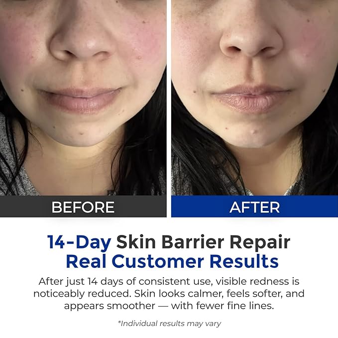 Intensive Repair Serum, 15%Hyaluronic Acid for Sensitive Skin Anti Aging Ultra Hydrating Serum for Face Calming Barrier Repair Redness Relief with Ceramides Centella 30Vials Daily Travel Care-FemmiqueWomen