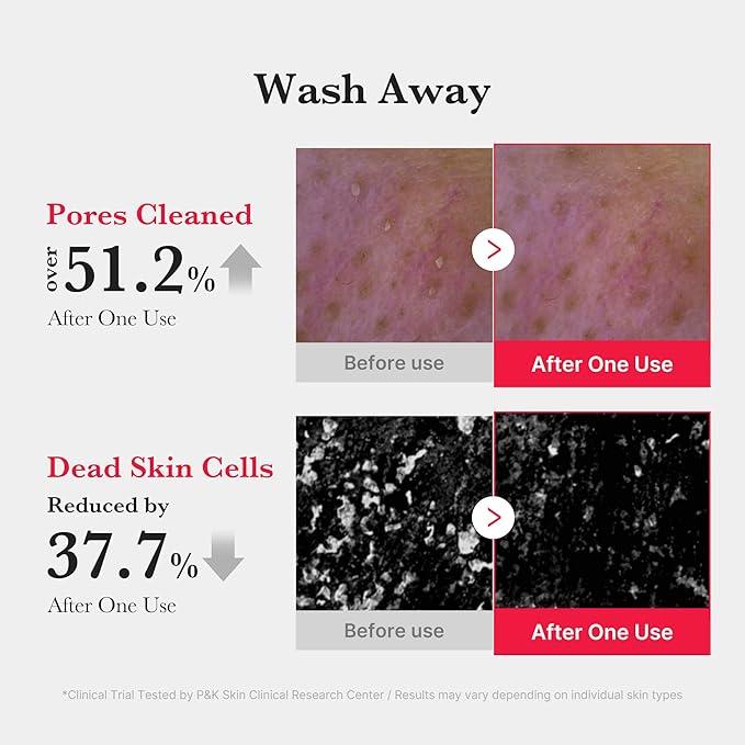 medicube Red Foam Cleanser - Deeply cleanses, remove impurities, control sebum, | Korean Skincare-FemmiqueWomen