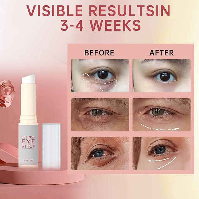1Pcs Retinol Eye Stick, Retinol Under Eye Cream for Puffiness and Dark Circles, Hydrating Eye Cream Anti Aging for Enhanced Under Eye Nourishment.-FemmiqueWomen