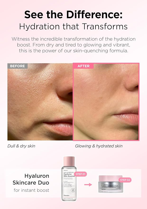 Hanskin Hyaluron Skin Essence, Hydrating Facial Astringent Toner for Dry, Dull, Sensitive Skin - Hyaluronic Acid Collagen Moisturizing Purifying Paraben-Free Korean Skincare [5.07 fl. oz.]-FemmiqueWomen
