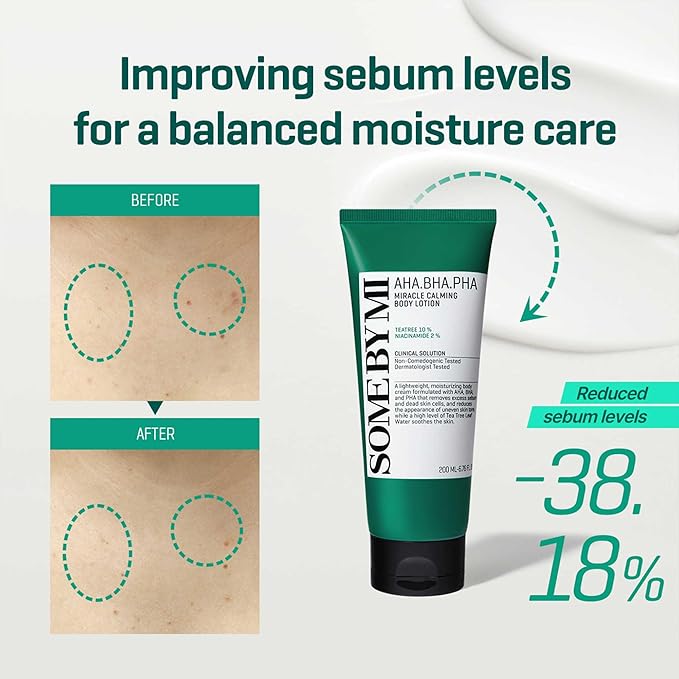 SOME BY MI AHA BHA PHA Miracle Calming Body Lotion – 6.76oz, 200ml – Korean Exfoliating Salicylic Acid Body Moisturizer for Dry Skin – Daily Hydration & Soothing Care with Centella – Korean Skin Care-FemmiqueWomen