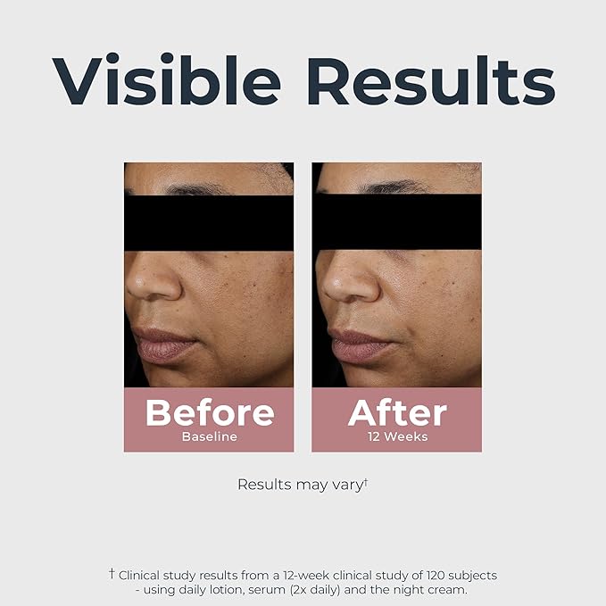 Eucerin Radiant Tone Night Cream, Dark Spot Corrector with Thiamidol, Night Moisturizer for Face Helps Visibly Reduce the Look of Persistent Dark Spots, All Skin Types, 1.7 Oz Bottle-FemmiqueWomen