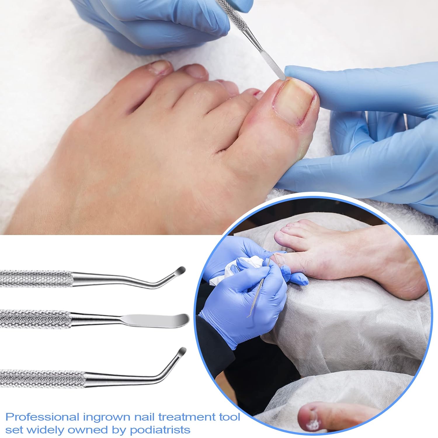 Ingrown Toenail Tool Removal Tool Kit, 10PCS Surgical Stainless Steel Professional Ingrown Toenail File and Lifters Manicure Care Treatment for Nail Correction Under Sidewall Clean-FemmiqueWomen