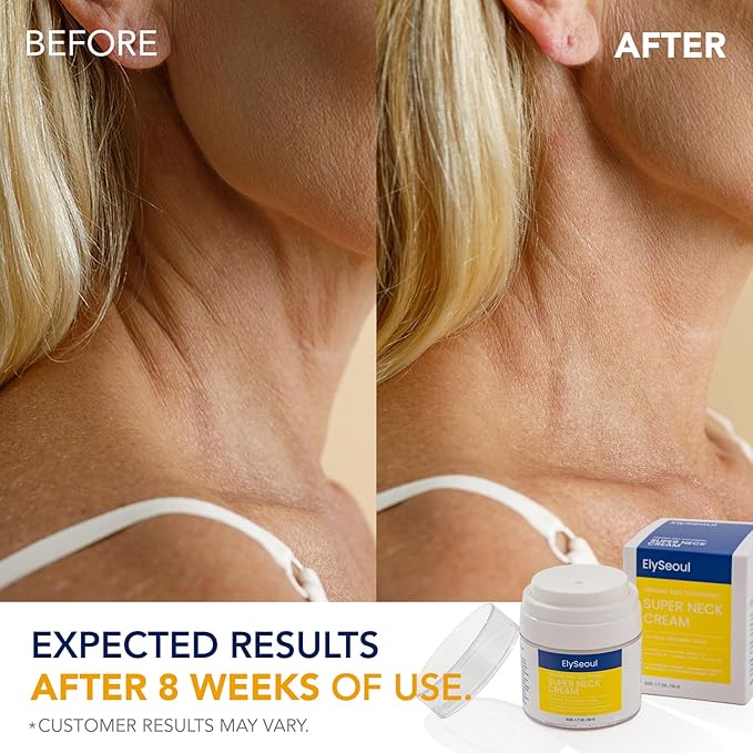 Korean Neck Cream for Firming & Tightening: Neck & Chest Anti-Aging Treatment for Crepey Sagging Skin & Wrinkles-FemmiqueWomen