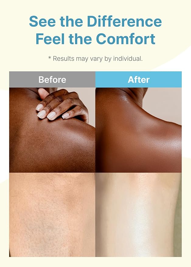 Derma B | Daily Moisture Body Oil | 99% Natural Argan & Sweet Almond Oil | Shower Oil for Dry Sensitive Skin | Light & Long-Lasting Hydration | Skin Body Care Oil with Peach Scent | 6.78 fl oz (200ml)-FemmiqueWomen