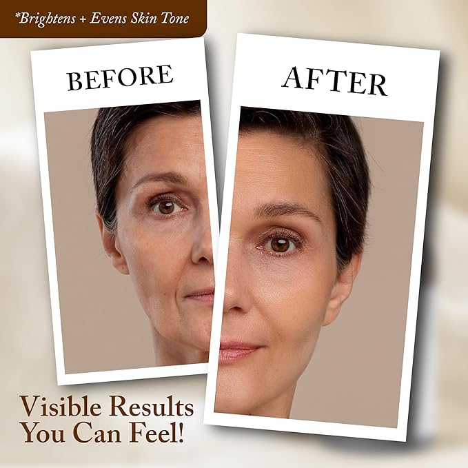 4 Oz Face Lift Mist - Hydrating Face Moisturizer with Green Tea & Niacinamide - Natural Skin Care Spray with Antioxidants, Amino Acids & Aloe for Brighter, Softer Complexion-FemmiqueWomen