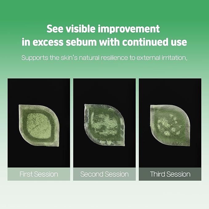 Cica Bio Spot Control Patch (1 Box, 62pcs) | Soothing Acne Patch for Redness & Blemishes | With Cica, Niacinamide & Tea Tree | Gentle for Sensitive Skin | Korean Skincare-FemmiqueWomen