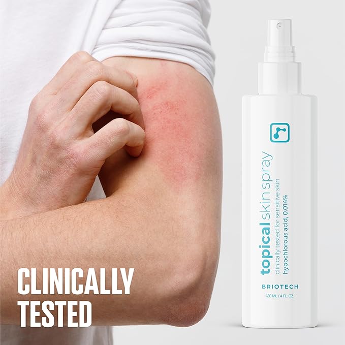 BRIOTECH Topical Skin Spray, Hypochlorous Acid Spray for Sensitive Skin, HOCl Facial Mist, Full Body Support Against Irritation, Calm Redness, Soothe Foot & Scalp, 2 oz Travel Size-FemmiqueWomen