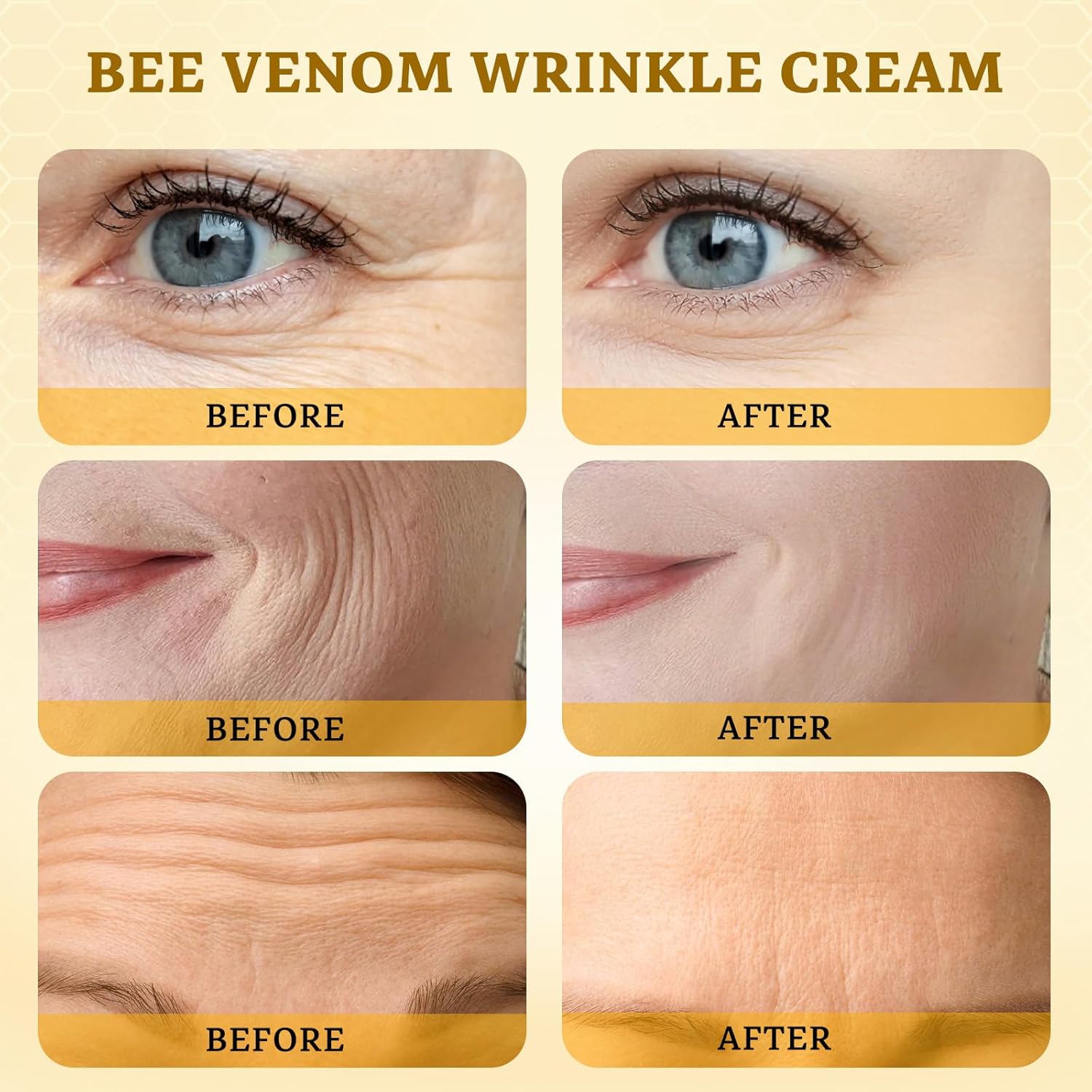2PCS Bee Venom Comprehensive Cream: Wrinkle Care Face Lift & Firming, Effective In Reducing Skin Blemishes, Natural Care and Non-Irritating, Bee Venom Joint Cream for All Body Parts, 60g * 2PCS-FemmiqueWomen
