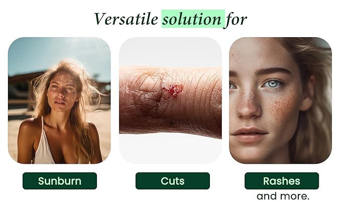 100% Pure & Organic Aloe Vera Spray, Clinically tested & Dermatologist approved, Hydrates & Heals Dry & Damaged Skin & Hair- 12 Oz-FemmiqueWomen