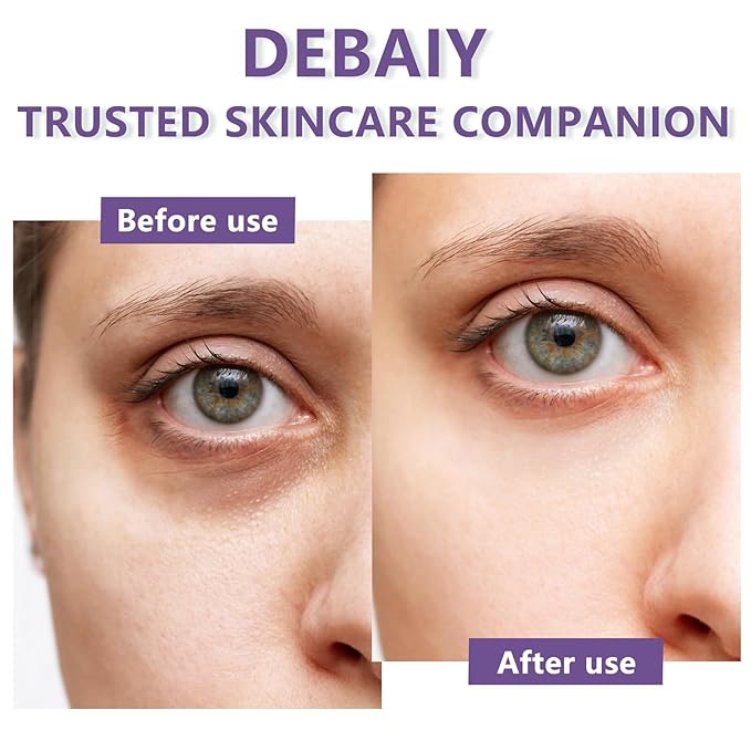 3 Pack Eye Cream Hydrating & Repairing with Hyaluronic Acid & Peptides - Moisturizes, Smooths Fine Lines, Enhances Elasticity (Each 0.529oz | 15g)-FemmiqueWomen