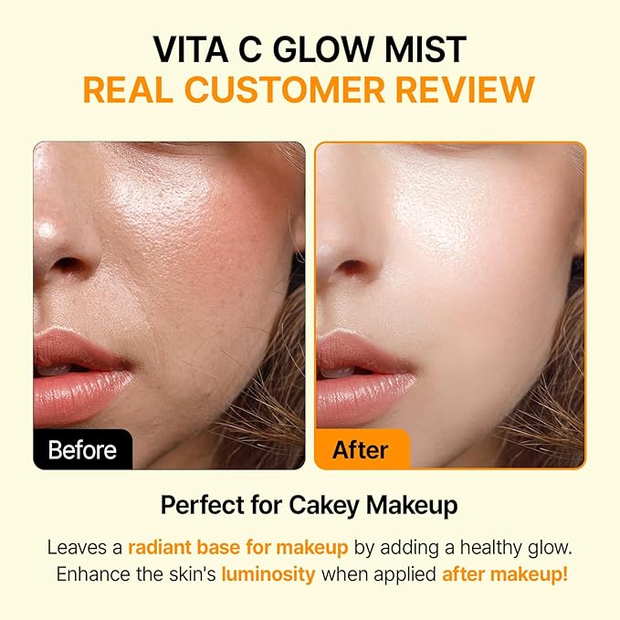 Vitamin C Mist with Niacinamide & Glutathione, Glow Mist for Dewy Skin, Makeup Setting Spray for face, Korean Skin Care, Vegan, 3.38 Fl Oz-FemmiqueWomen