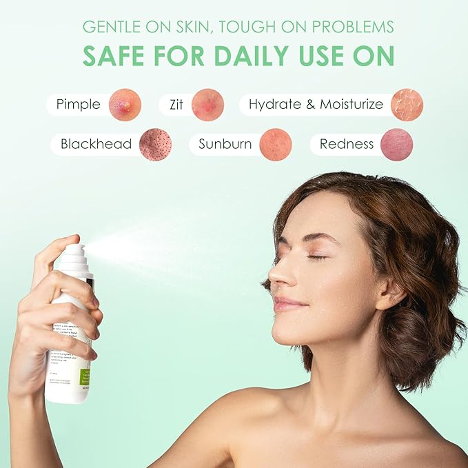 AUSLKA Salicylic Acid Oil Balancing Spray with 2% Salicylic Acid Regulates Skin Balance for Pimple and Oily Skin, Fruit Acid Spray for Face & Body (3.4 Fl Oz)-FemmiqueWomen