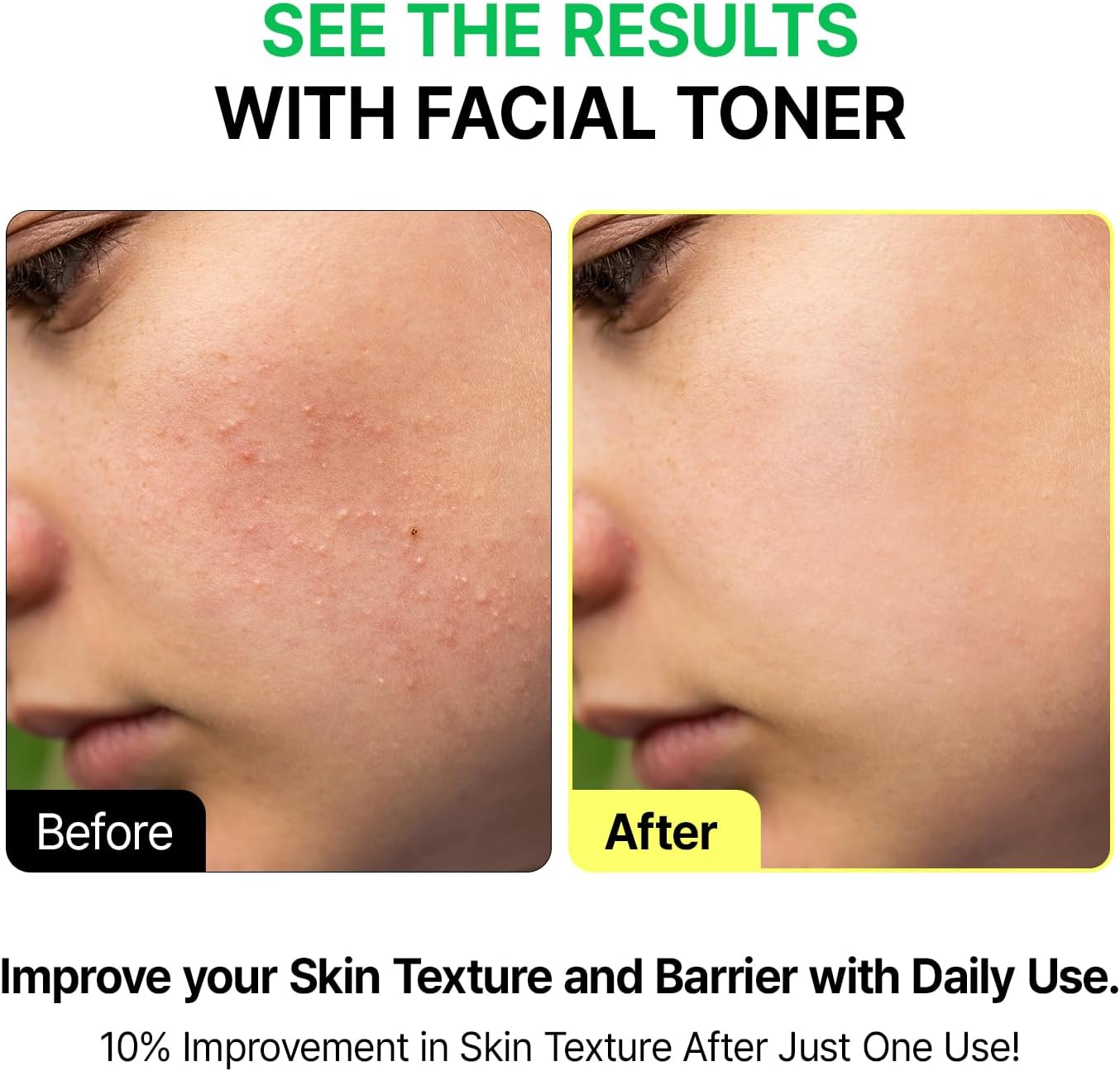 VEGANIFCET Essence, Ultra Hydrating, for Glowing Skin, Korean Skin Care, Vegan, 6.76 Fl Oz-FemmiqueWomen