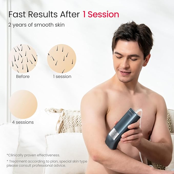 IPL Laser Hair Removal for Men, Dual Lights 100W, 35°F Sapphire Ice-Cooling, Quadruple-Pulse PHR Mode for Stubborn Hair, at Home Hair Removal Device for Armpits, Chest and Leg-FemmiqueWomen