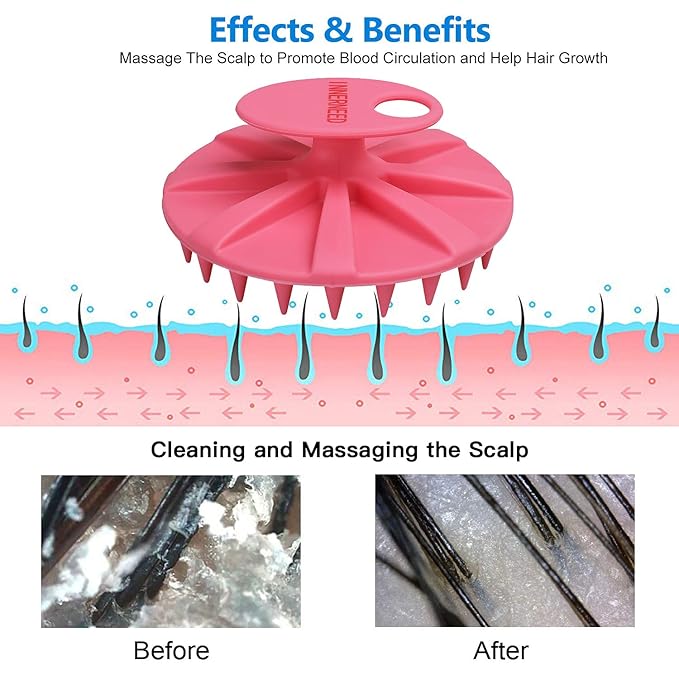 INNERNEED Scalp Massager Shampoo Brush, Wet & Dry Manual Scalp Care Head Scrubber Hair Washing, Soft Silicone Bristles, for Hair Growth, Dandruff Removal, Comfortable for All Hair Types (Pink)-FemmiqueWomen