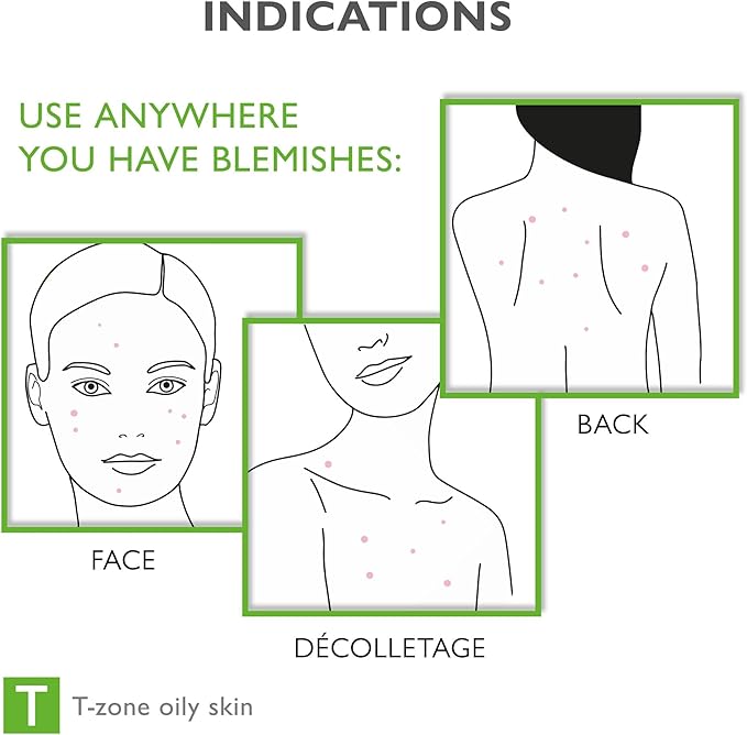 Face & Body Breakout Solution - 3% Mandelic Acid Helps Clarify Blemish & Acne Prone Skin, Face, Back & Chest Pimples Exfoliating & Clearing Treatment, SEBO-ALMOND-CLARIS, 6.42 fl oz-FemmiqueWomen