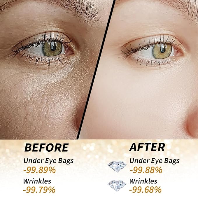 24k Gold Under Eye Patches - 60 Pcs Eye Mask Pure Gold Anti-Aging Collagen Hyaluronic Acid Under Eye Mask for Dark Circles, Puffiness & Wrinkles Refresh Your Skin-FemmiqueWomen