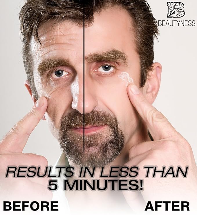 Instant Ageless Eye Cream – Anti Wrinkle Cream, Removes Under Eye Puffiness, Bags, Expression Lines, & Dark Circles. Powerfully Tighen & Lifts Sagging Skin. Disappears Before Your Eyes In Minutes.-FemmiqueWomen