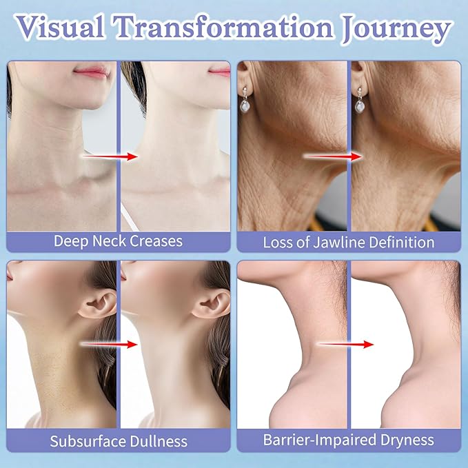 Neck Creams for Tightening and Firming - Anti Wrinkle & Treatment with Retinol Peptides, Ceramide - Overnight Moisturizer for All Skin Types - Sensitive Safe-FemmiqueWomen