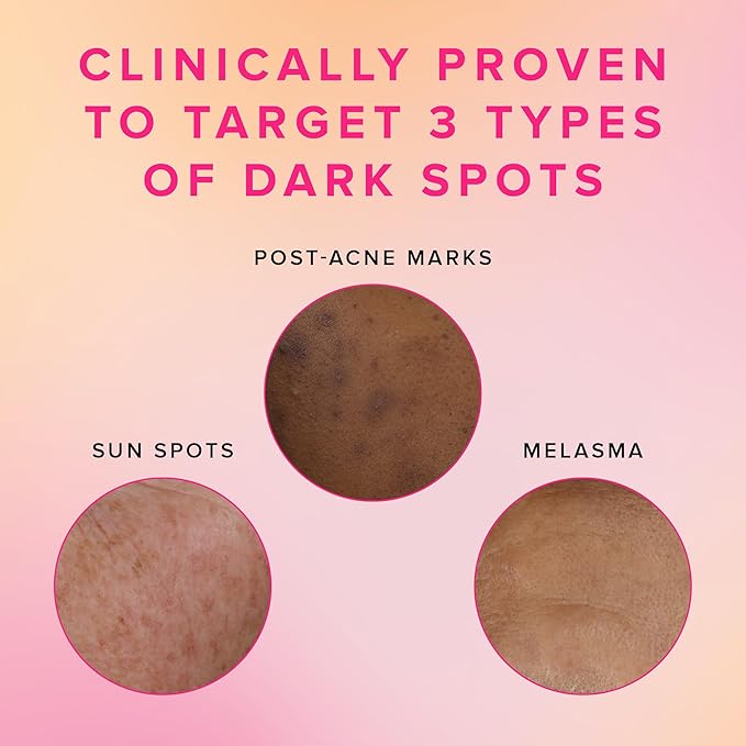 Farmacy 3% TXA Toner for Face - Brightening Face Toner for Oily Skin - Liquid Exfoliant with Azelaic Acid + 5% PHA to Target Visible Dullness + Help Reduce Uneven Skin Tone (50ml)-FemmiqueWomen