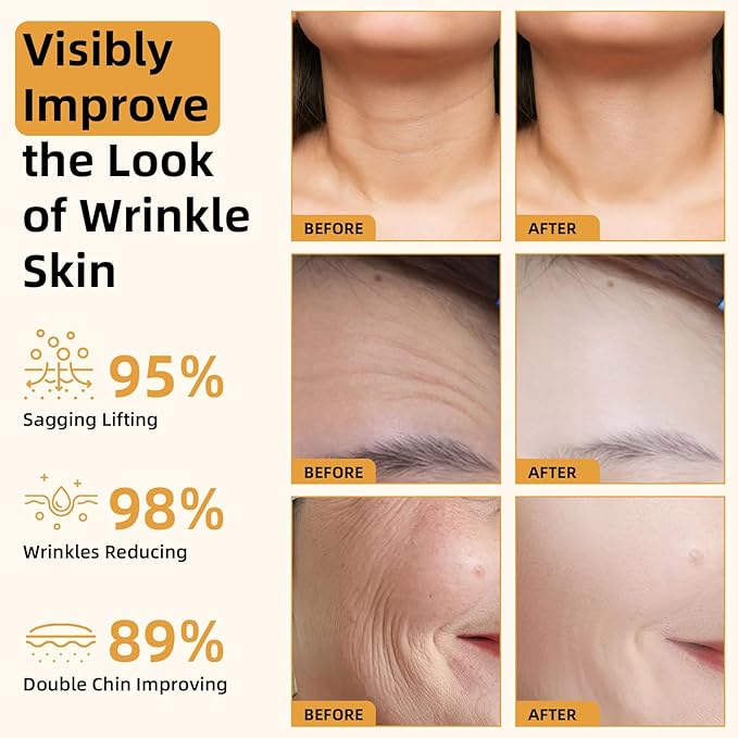 Bee Venom Firming Serum Stick, 2PCS Anti-Aging Face Cream, Lifts and Tightens the Skin, Hydrating, Lifting & Restoring Skin Elasticity, Bee Venom Body Tightening Cream for Women & Men-FemmiqueWomen