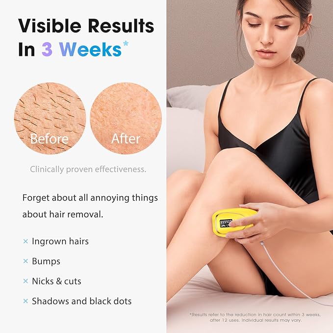 IPL Laser Hair Removal Device for Women & Men - Home 45°F Ice-Cooling Contact for Painless & Long-Lasting Results, 86% Hair Reduction in 3 Weeks for Full Body & Bikini Line, Light Yellow-FemmiqueWomen