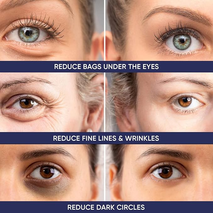 Instant Ageless Eye Cream – Anti Wrinkle Cream, Removes Under Eye Puffiness, Bags, Expression Lines, & Dark Circles. Powerfully Tighen & Lifts Sagging Skin. Disappears Before Your Eyes In Minutes.-FemmiqueWomen