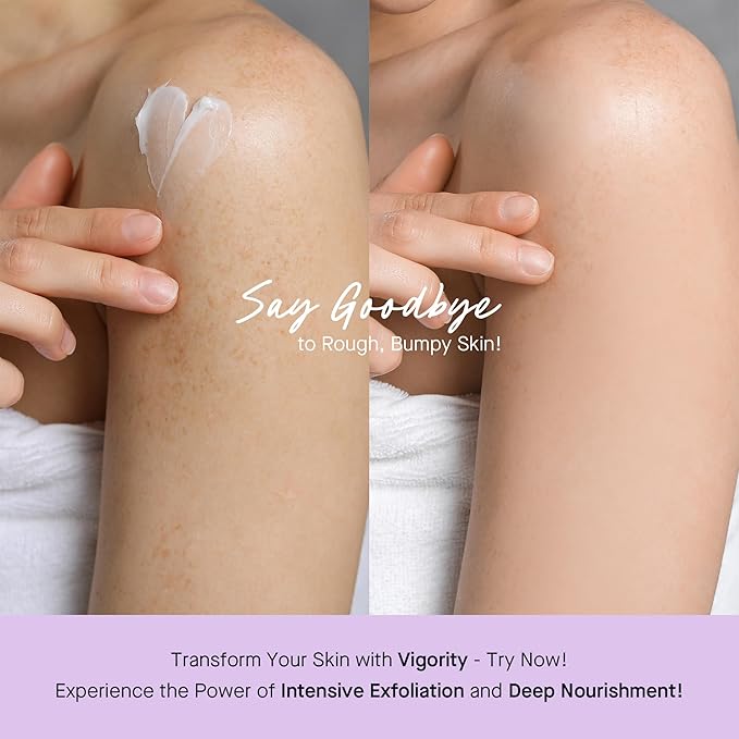 Vigority Keratosis Pilaris Treatment Cream with Lactic Acid – KP Body Bump Exfoliating Moisturizer for Rough, Bumpy, Dry & Flakey Skin, Strawberry Legs – 5.1 Oz-FemmiqueWomen