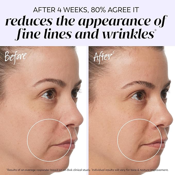 Olay Retinol 24 Face Moisturizer, Anti-Aging Night Cream for Women, Fragrance-Free, Non Greasy - Anti-Wrinkle, Smooth Fine Lines, Tightening, Hydrating Skin Care - Peptides, Glycerin, 1.7 Oz-FemmiqueWomen