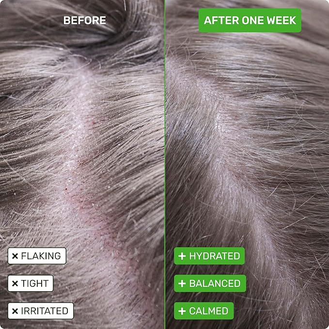 Ethique Scalp Health Shampoo Bar for itchy, dry, flaky scalps with Oatmeal - Plastic-Free, Vegan, Cruelty-Free, 3,88 oz - Formerly Heali Kiwi-FemmiqueWomen