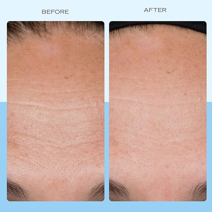 First Aid Beauty Firming Collagen Cream with Collagen, Peptides and Niacinamide – Day + Night Anti-Aging Face Moisturizer – 1.7 fl oz-FemmiqueWomen