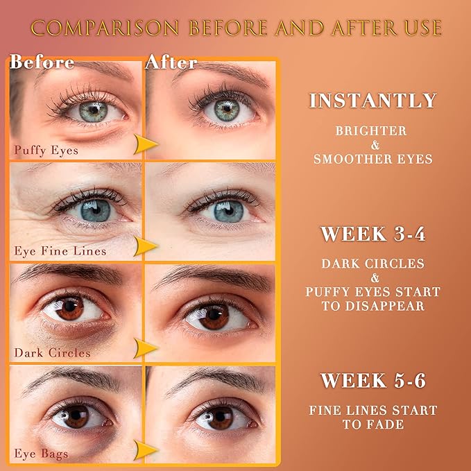 24K GOLD Eye Mask– 60 Pcs - Gold Under Eye Mask Retinol & Collagen - Puffy Eyes and Dark Circles Treatments – Look Younger and Reduce Wrinkles and Fine Lines Undereye-FemmiqueWomen