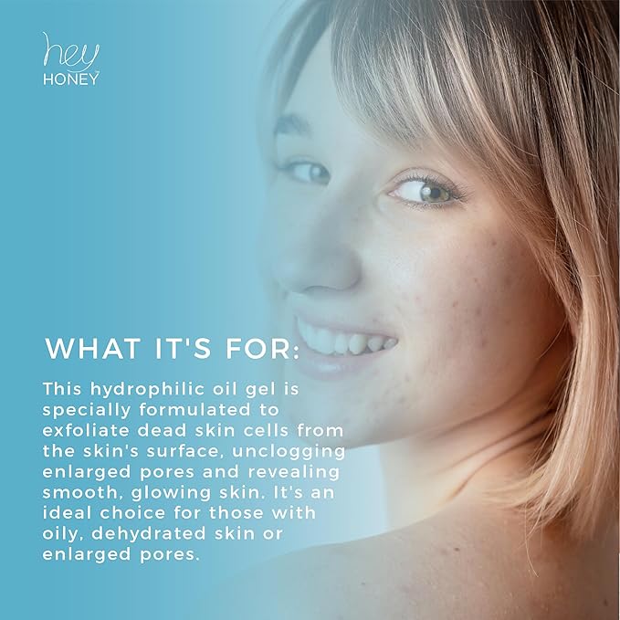 Hey Honey Skincare Be Clear - Acne Control Deep Pores Cleansing Gel | Propolis, Green Tea Oil, Camellia | Exfoliates, Unclogs Pores, Balances Oil Production | Fast Acting & Long Lasting | 2.7 Oz-FemmiqueWomen
