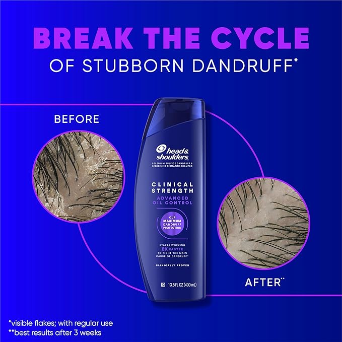 Head & Shoulders Clinical Dandruff Shampoo Twin Pack, Prescription Strength, Oil & Flake Control, Seborrheic Dermatitis Relief, Citrus, 13.5 Fl Oz Each (Set of 2)-FemmiqueWomen