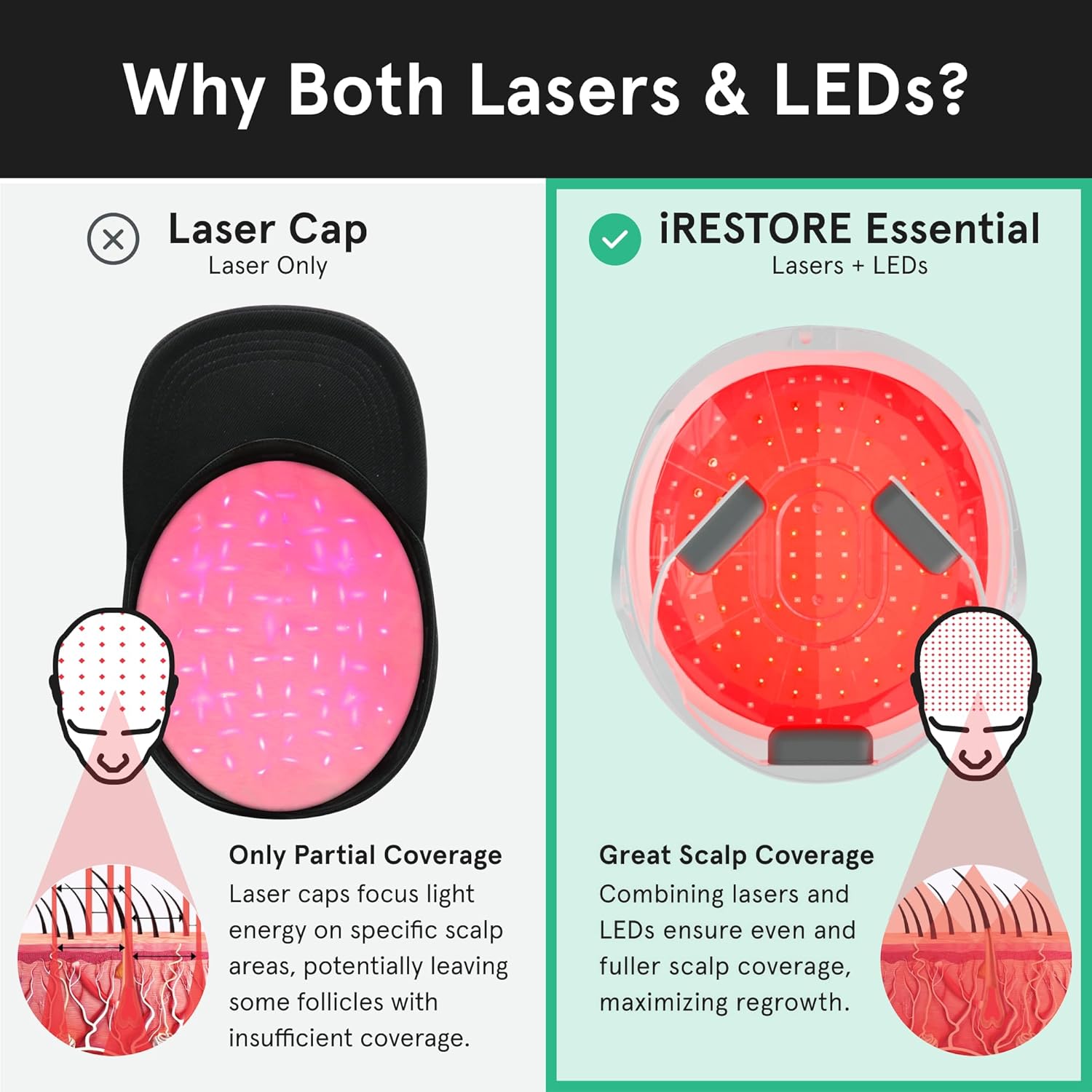 iRestore Essential - Laser Red Light Therapy for Hair Growth - FDA Cleared Hair Loss, Hair Thinning & Alopecia Treatment for Men & Women - Laser Cap for Hair Regrowth Stimulate Denser Fuller Hair-FemmiqueWomen