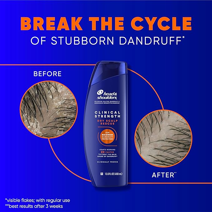 Head & Shoulders Clinical Dandruff Defense + Dry Scalp Rescue Shampoo 13.5 oz Twin Pack-FemmiqueWomen