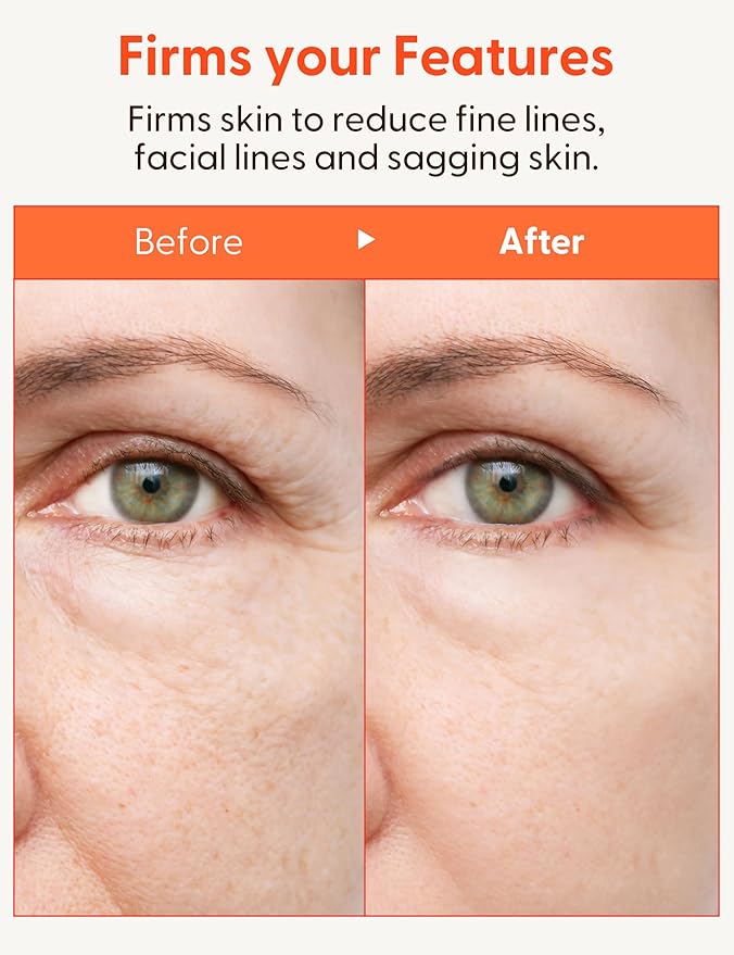 It'S SKIN Collagen Nutrition Eye Cream - Eye Bag Cream Eye Care w/Collagen | Korean Eye Cream for Dark Circles and Puffiness | Beauty & Personal Care Under Eye Cream for Puffiness and Bags 0.88 oz-FemmiqueWomen