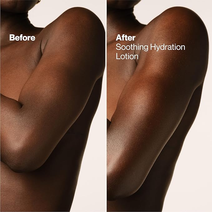 Suave Soothing Hydration Hand & Body Lotion With Aloe Vera Refreshes Dry Skin, Fast Absorbing, Intensive Moisturizing Cream For Women, Non Greasy, Allergen Free, 18 FL OZ, 6 Pack-FemmiqueWomen