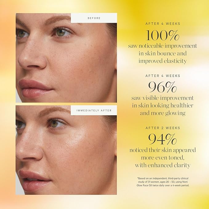 KORA Organics Noni Glow Hydrating Face Oil for Women with Rosehip, Gua Sha Oil, Certified Organic, Cruelty Free, 1.69 fl oz-FemmiqueWomen