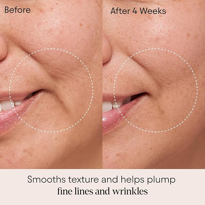 ALPYN Clarifying Facial Oil with Retinol & Pink Algae | Clear Congestion, Smooth Fine Lines, Improve Texture & Glow | 1 Fl Oz / 30 ml-FemmiqueWomen