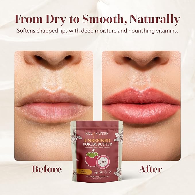 era of nature Kokum Butter Raw - 32 oz (2lb) – Natural Butter for Body Butters, Lotion Bars, Lip Balm, Soap Making – Blends Well with Shea or Cocoa Butter – For Stretch Marks, Scars, Pregnancy Care-FemmiqueWomen