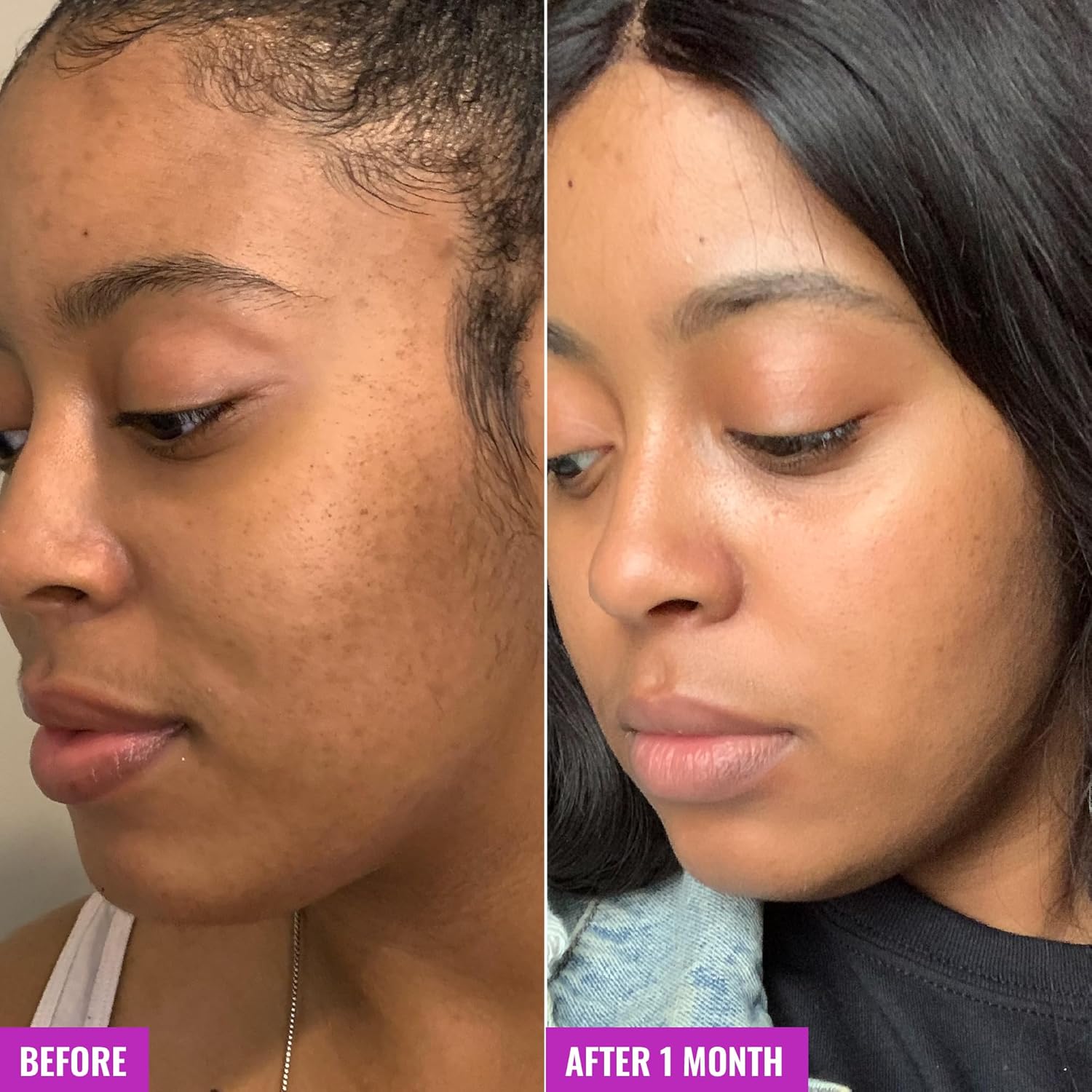 Good Molecules Glycolic Exfoliating Toner - Hyaluronic and Glycolic Acid Daily Toner for Face - Cleansing Facial Exfoliant for Glowing Even Skin Tone, Skin Care-FemmiqueWomen